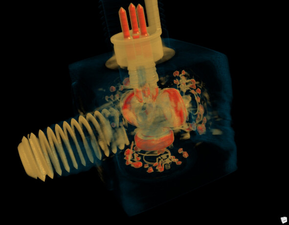 Рентгенозащитные системы «ЭТНА» - повышаем безопасность и производительность рентгеновского контроля фото 6