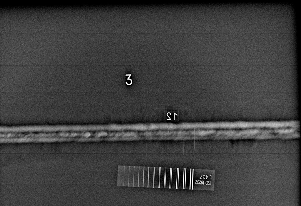 Рентгеновский аппарат сигнализирует: 6 симптомов, которые требуют срочной диагностики фото 2