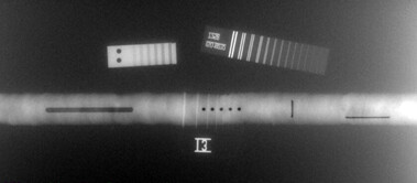 Рентгеновские аппараты «ЭТНА-М» фото 2