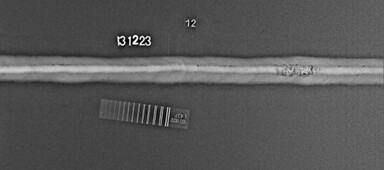 Рентгеновские аппараты «ЭТНА-М» фото 1